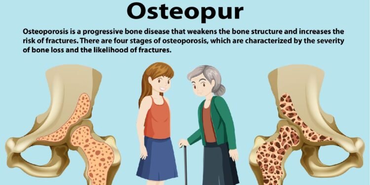 osteopur