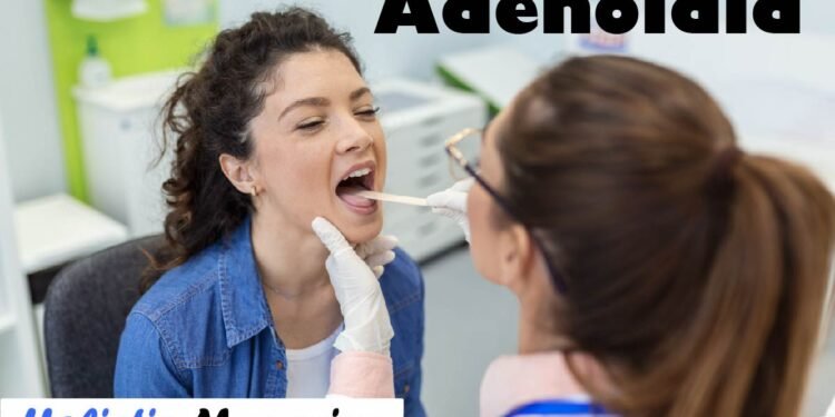 Adenoidid